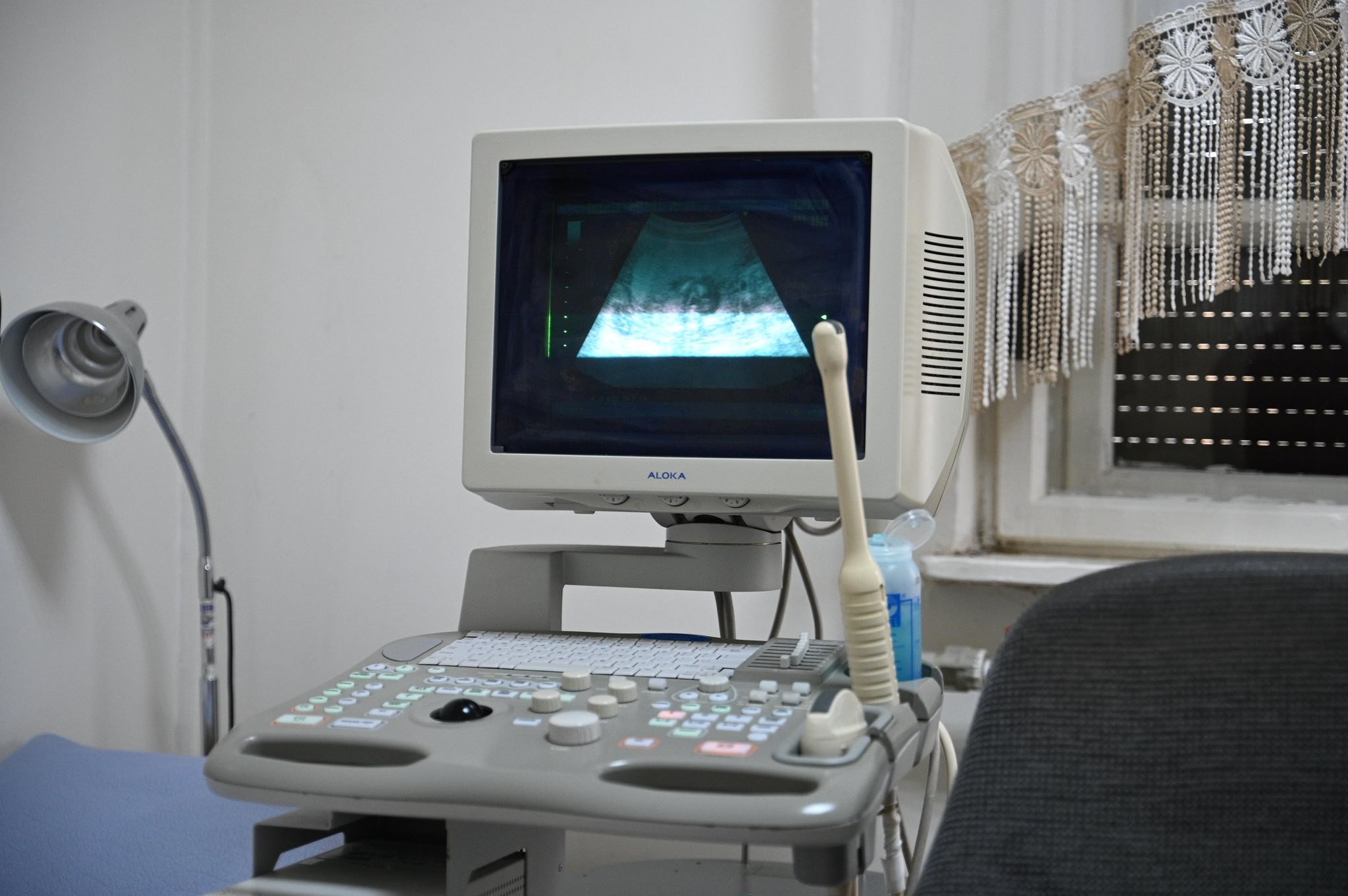 На Закарпатті народився перший малюк, зачатий завдяки державній програмі безоплатного лікування безпліддя